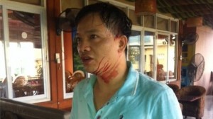 Nguyen was attacked in May, after posting pro-democracy messages on Facebook