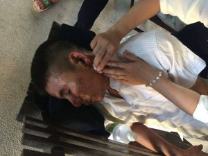 Pro-democracy activist Nguyen Trung Truc was beaten by plain clothes agents in Nghe An on July 10, 2016