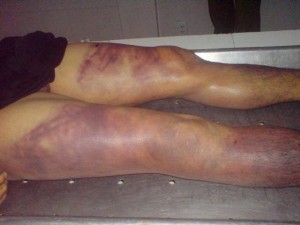One of many victims tortured by Vietnamese police