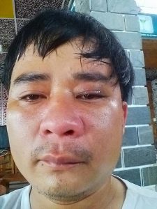 blogger Nguyen Van Thanh was assaulted on July 3, the third attack within three weeks